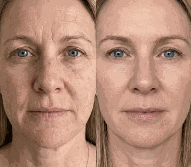 Résultat Glowbaume