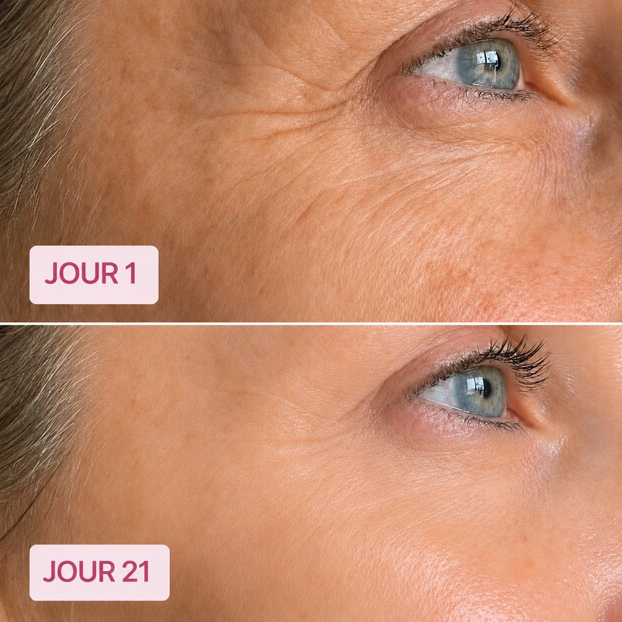 Résultat Glowbaume